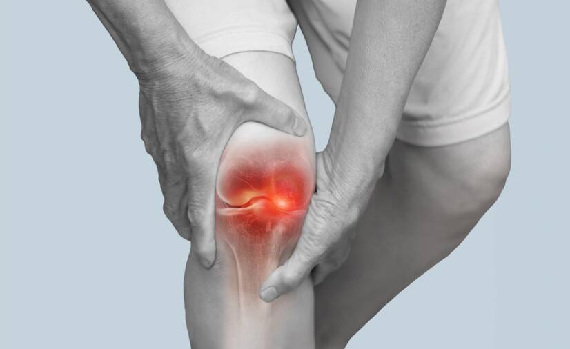 نمای نزدیک از عکس رادیوگرافی (X-ray) که کاهش فاصله مفصلی در زانوی مبتلا به استئوآرتریت را نشان میدهد