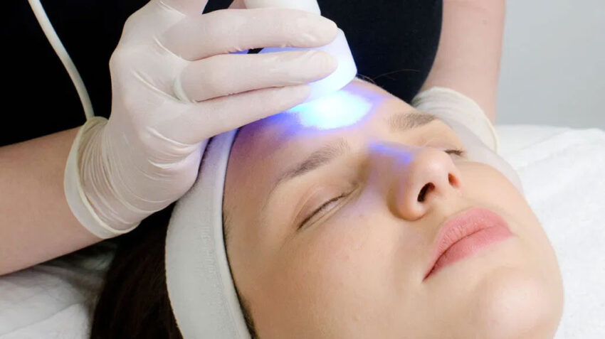تصویری از صورت یک خانم که توسط پزشک لیزر کم توان Low Power Laser انجام میدهد